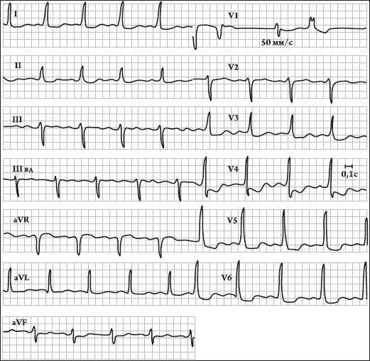 Иллюстрация к книге — Карманный справочник медицинских анализов [Autogen_eBook_id27.jpg]
