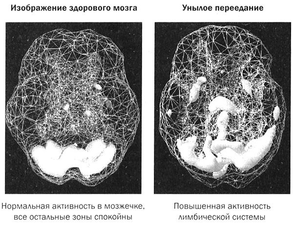 Иллюстрация к книге — Мозг против лишнего веса [i_021.jpg]