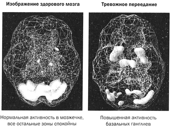 Иллюстрация к книге — Мозг против лишнего веса [i_022.jpg]