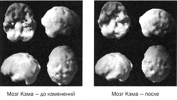 Иллюстрация к книге — Мозг против лишнего веса [i_035.jpg]