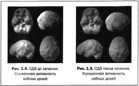 Иллюстрация к книге — Великолепный мозг в любом возрасте [img05.jpg]