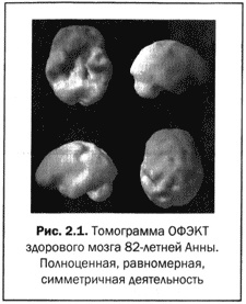 Иллюстрация к книге — Великолепный мозг в любом возрасте [img07.jpg]