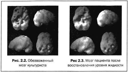 Иллюстрация к книге — Великолепный мозг в любом возрасте [img08.jpg]