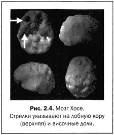 Иллюстрация к книге — Великолепный мозг в любом возрасте [img09.jpg]