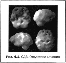 Иллюстрация к книге — Великолепный мозг в любом возрасте [img13.jpg]