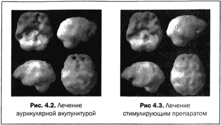 Иллюстрация к книге — Великолепный мозг в любом возрасте [img14.jpg]