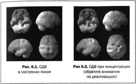Иллюстрация к книге — Великолепный мозг в любом возрасте [img16.jpg]