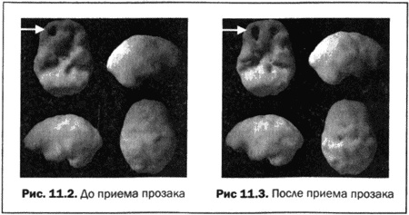 Иллюстрация к книге — Великолепный мозг в любом возрасте [img20.jpg]