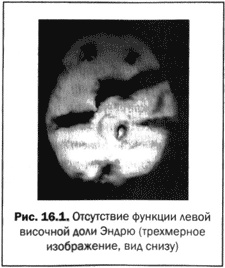 Иллюстрация к книге — Великолепный мозг в любом возрасте [img22.jpg]
