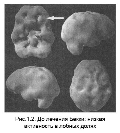 Иллюстрация к книге — Измени свой мозг - изменится и тело! [i_003.jpg]