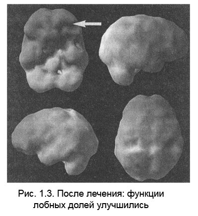 Иллюстрация к книге — Измени свой мозг - изменится и тело! [i_004.jpg]