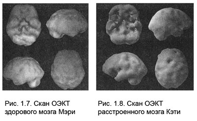 Иллюстрация к книге — Измени свой мозг - изменится и тело! [i_007.jpg]