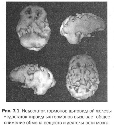 Иллюстрация к книге — Измени свой мозг - изменится и тело! [i_025.jpg]