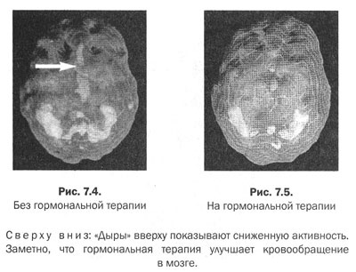 Иллюстрация к книге — Измени свой мозг - изменится и тело! [i_027.jpg]