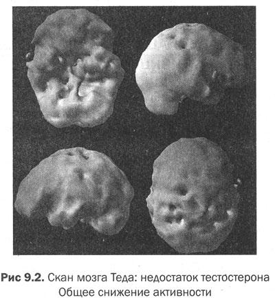 Иллюстрация к книге — Измени свой мозг - изменится и тело! [i_036.jpg]