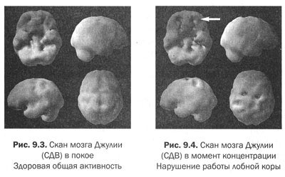 Иллюстрация к книге — Измени свой мозг - изменится и тело! [i_037.jpg]