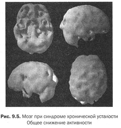 Иллюстрация к книге — Измени свой мозг - изменится и тело! [i_038.jpg]