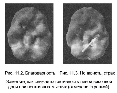 Иллюстрация к книге — Измени свой мозг - изменится и тело! [i_044.jpg]