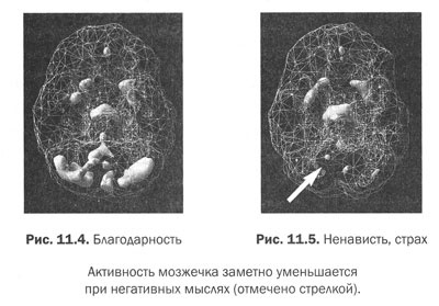 Иллюстрация к книге — Измени свой мозг - изменится и тело! [i_045.jpg]
