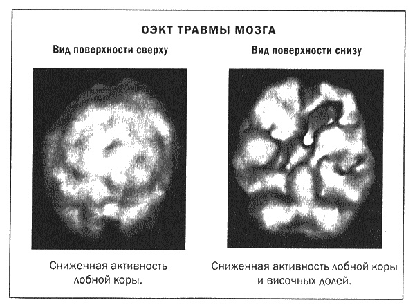 Иллюстрация к книге — Мозг и душа. Новые открытия о влиянии мозга на характер, чувства, эмоции [i_019.jpg]
