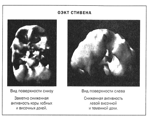 Иллюстрация к книге — Мозг и душа. Новые открытия о влиянии мозга на характер, чувства, эмоции [i_020.jpg]
