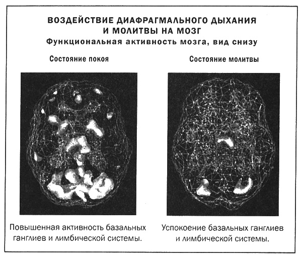Иллюстрация к книге — Мозг и душа. Новые открытия о влиянии мозга на характер, чувства, эмоции [i_041.jpg]