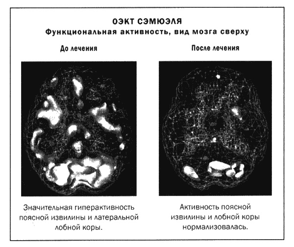 Иллюстрация к книге — Мозг и душа. Новые открытия о влиянии мозга на характер, чувства, эмоции [i_043.jpg]