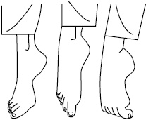 Иллюстрация к книге — Плоскостопие. Самые эффективные методы лечения [Autogen_eBook_id23.jpg]