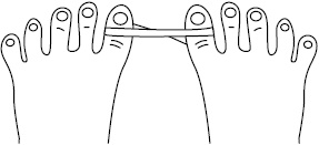 Иллюстрация к книге — Плоскостопие. Самые эффективные методы лечения [Autogen_eBook_id26.jpg]