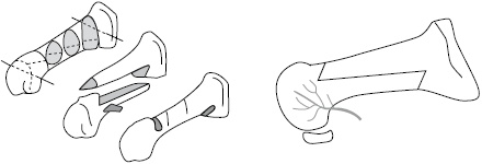 Иллюстрация к книге — Плоскостопие. Самые эффективные методы лечения [Autogen_eBook_id33.jpg]