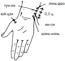 Иллюстрация к книге — 700 китайских упражнений для лечения и предотвращения 100 болезней [Autogen_eBook_id185.jpg]