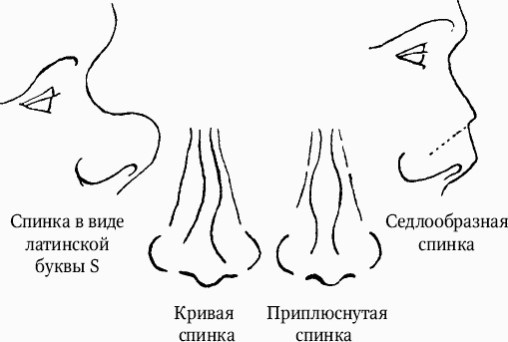 Иллюстрация к книге — Как распознать преступника [image17.jpg]