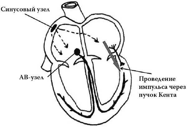 Иллюстрация к книге — О чем расскажет ЭКГ [_10.jpg]