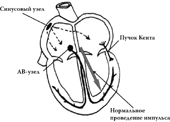 Иллюстрация к книге — О чем расскажет ЭКГ [_9.jpg]