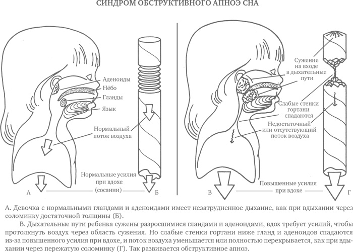 Иллюстрация к книге — Сон ребенка. Решение всех проблем [i_022.jpg]