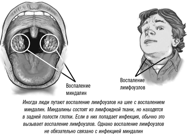 Иллюстрация к книге — Первая помощь своими руками. Если скорая не спешит [i_090.jpg]