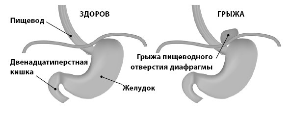 Иллюстрация к книге — Кишечник с комфортом, желудок без проблем [i_025.jpg]