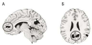 Иллюстрация к книге — Зависимый мозг. От курения до соцсетей. Почему мы заводим вредные привычки и как от них избавиться [i_007.jpg]