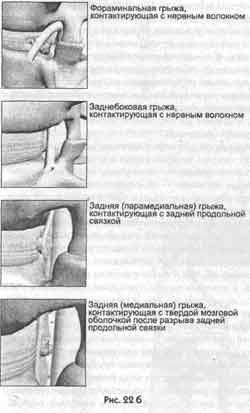Иллюстрация к книге — Победить боль в спине [i_016.jpg]