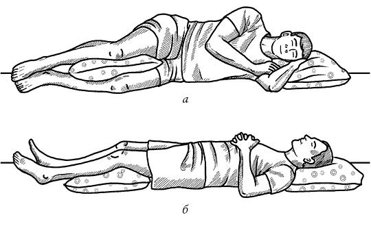 Иллюстрация к книге — Жизнь без боли в спине. Лечение сколиоза, остеопороза, остеохондроза, межпозвонковой грыжи без операции [i_151.jpg]