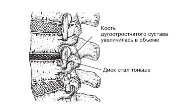 Иллюстрация к книге — Боль в спине. Как определить причину и устранить приступ [i_004.jpg]