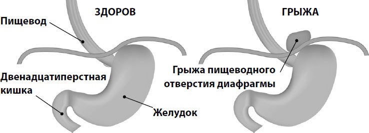 Иллюстрация к книге — Пора лечиться правильно. Медицинская энциклопедия [i_007.jpg]