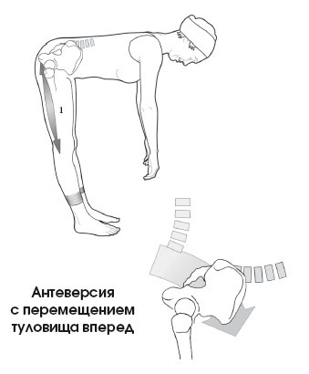 Иллюстрация к книге — Диагностика и лечение позвоночника. Уникальная система доктора А. М. Уриа [i_082.jpg]