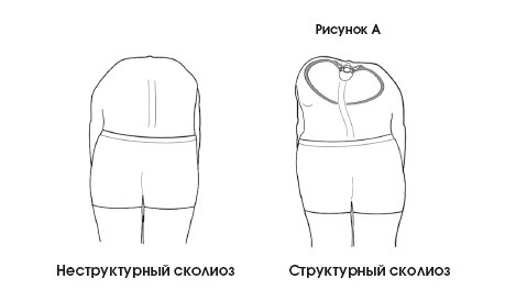 Иллюстрация к книге — Диагностика и лечение позвоночника. Уникальная система доктора А. М. Уриа [i_270.jpg]