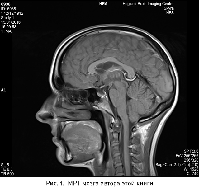 Иллюстрация к книге — Мой продуктивный мозг. Как я проверила на себе лучшие методики саморазвития и что из этого вышло [i_002.jpg]
