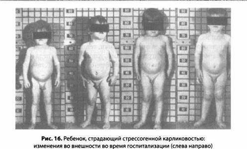 Психология стресса