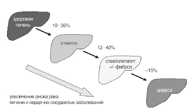 Иллюстрация к книге — Неалкогольная жировая болезнь печени [i_005.jpg]