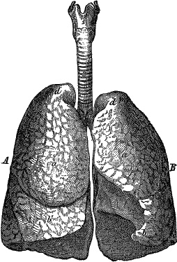Иллюстрация к книге — Модицина. Encyclopedia Pathologica [_40.jpg]