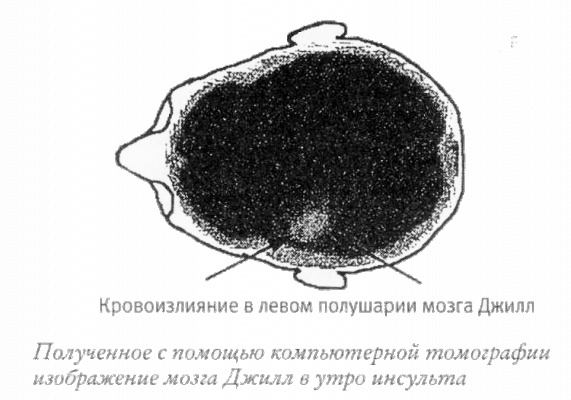 Иллюстрация к книге — Мой инсульт был мне наукой. История собственной болезни, рассказанная нейробиологом [_121309.jpg]