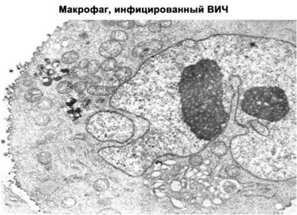 Иллюстрация к книге — Имя ему СПИД. Четвертый всадник Апокалипсиса [i_021.jpg]
